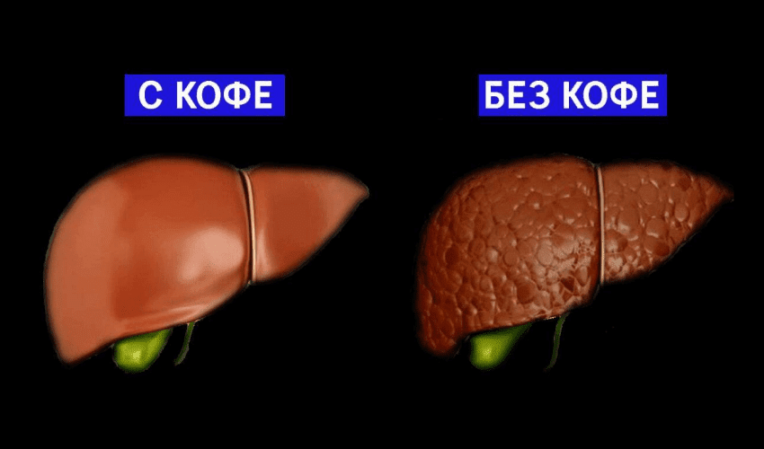 Жесткость печени